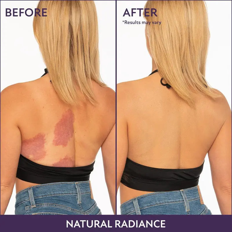 🌞Frühlingserwachen: 50% Rabatt!✨Body Coverage Perfector + Extra großer Pufferpinsel | 12h wasserfest | Kaschiert Tattoos/Narben | Perfekt für Fotos!