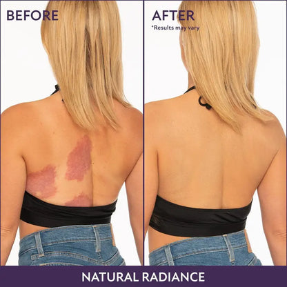 🌞Frühlingserwachen: 50% Rabatt!✨Body Coverage Perfector + Extra großer Pufferpinsel | 12h wasserfest | Kaschiert Tattoos/Narben | Perfekt für Fotos!