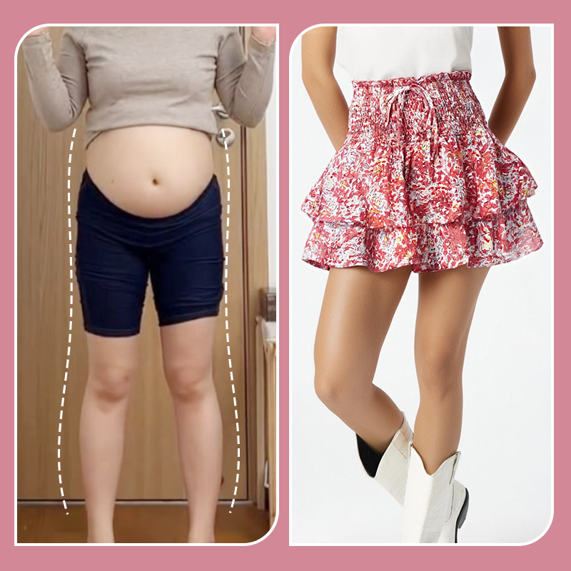 🌞Frühlingserwachen: 50% Rabatt!💕"Bauch-Weg" Sommer-Skort: Luftiger Etagenrock mit integrierter Sicherheitshose