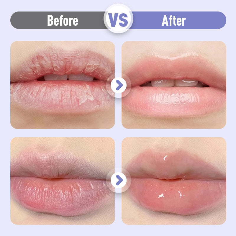 👄Aufpolsterndes und feuchtigkeitsspendendes Lippenserum gegen Falten👄