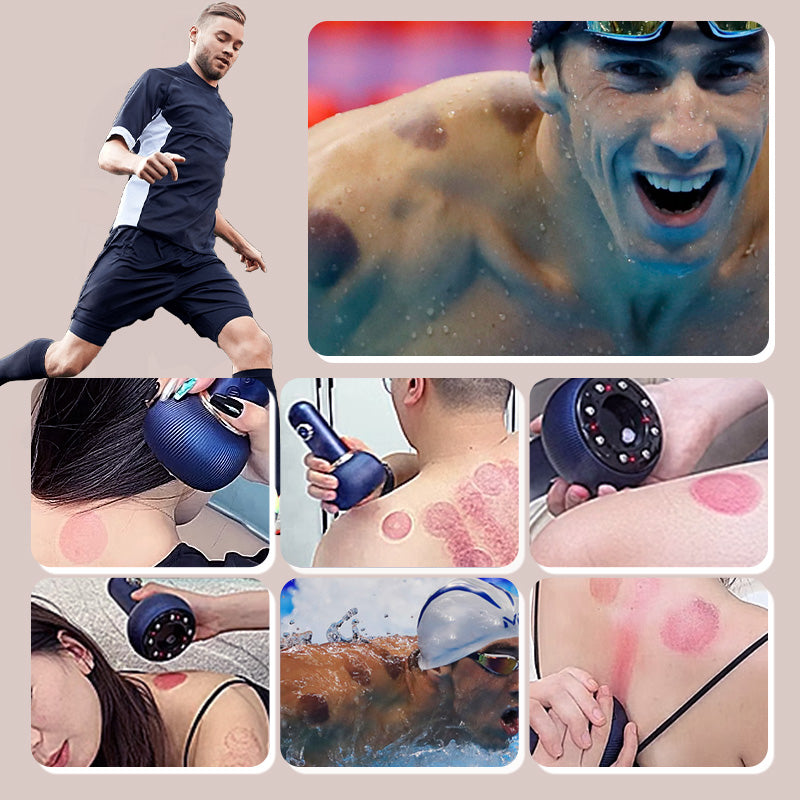 ⏳ Zeitbegrenzte Special⌛Electric Cupping Therapie Massager & Meridian Pinselset